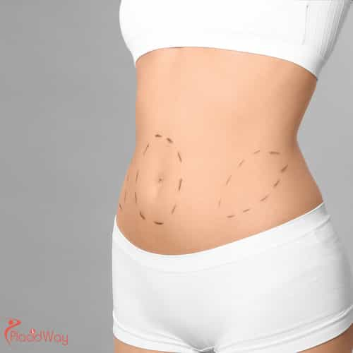 Why Americans & Canadians Are Choosing Laser Liposuction in Colombia for Affordable, High-Quality Body Contouring